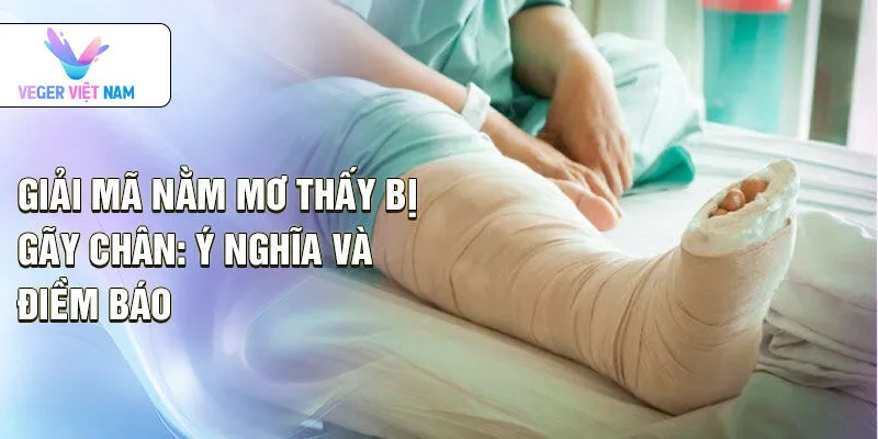 Giải mã nằm mơ thấy bị gãy chân: ý nghĩa và điềm báo